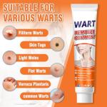 Wart and Skin Tag Remover Cream 20g
