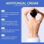 Soothing Antifungal Cream for Fast Relief