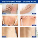 Soothing Antifungal Cream for Fast Relief