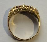 Edwardian 18ct Gold Ruby and Diamond Ring