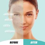 Ultra Soft Disposable Face Towels – 50 Count