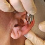 Crystal-Free Microdermabrasion Techniques DVD Training