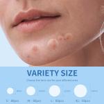 Daolyo Pimple Patches for Face, 4 Size 300 Counts Acne Patches, Hydrocolloid Patches for Covering Zits and Blemishes, Spot Stickers with Salicylic Acid, Tea Tree Oil & Calendula Oil