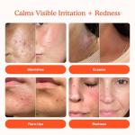 Tower 28 SOS Daily Rescue Facial Spray for Sensitive Skin, Hypochlorous Acid Spray Helps Visibly Reduce the Appearance of Redness and Breakouts, Travel Size Toner for Face, 1 FL Oz