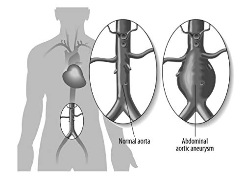 EMT (Emergency Medical Technician) Crash Course with Online Practice Test, 2nd Edition: Get a Passing Score in Less Time (EMT Test Preparation) from Research & Education Association