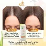 Ritalia® Hair Growth Spray | Hair Loss Treatment for Women & Men | Advanced Hair Regrowth Treatment with Saw Palmetto | DHT Blocker & Hair Growth Serum for Fuller Hair