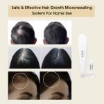Scalp Microneedling Kit | Glowmedix Scalp Microneedling Pen & Hair Growth Serum | Multi-peptide Serum for Hair Growth for Men and Women| DHT blocker Saw Palmetto for Hair