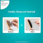 Pilgrim RootActive Anti-Hairfall Serum With Spanish Rosemary, Caffeine, Biotin, Capilia Longa, Saw Palmetto (30ml) | Strengthens Hair Roots, Reduces hair loss & Increases Hair Density | Men and Women