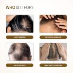 Bare Anatomy Advanced Hair Density Roll-On 3% Redensyl + 4% Anagain + 2% Baicapil + 5% Rosemary, Rice Water, Biotin & Saw Palmetto Reduces Hair Fall, Supports Hair Growth Black 25 ml