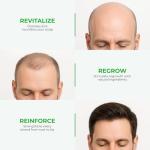 Green Wealth Neo Hair Lotion for Hair Loss Treatment | Hair Regrowth | Thinning, Soon Spots & Hair Fall | Trusted Formula with Ginseng, Saw Palmetto & Horsetail | 120 ml / 4.06 fl oz (Pack of 3)