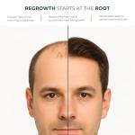 Green Wealth Neo Hair Lotion for Hair Loss Treatment | Hair Regrowth | Thinning, Soon Spots & Hair Fall | Trusted Formula with Ginseng, Saw Palmetto & Horsetail | 120 ml / 4.06 fl oz (Pack of 3)