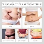 Weight Loss Patch, Slim Patch, 50 Pcs Slimming Patch, Fat Burning Patches for Belly Fat, Waist Slimming, Metabolism Support Anti-Cellulite, Fast and Gentle Fat Reduction