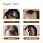 Bare Anatomy Advanced Roll-On 3% Redensyl + 4% Anagain + 2% Baicapil + 5% Rosemary, Rice Water, Biotin & Saw Palmetto Reduces Hair Fall, Supports Hair Growth Hair Growth Serum 25 ml