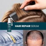HairMD Clinical Hair Growth Complex Meso Serum - Hyaluronic Acid Serum - Biotin - Saw Palmetto - Provitamin B5 - Expertly Designed by Hair Transplant Experts To Stimulate Hair Growth