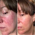WildMint 5-Step Skincare Kit for Menopause