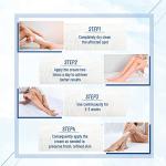 OUKEYA 40% Urea Cream for Dry Skin Relief