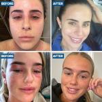 Natural Eczema Cream for Face and Eyelids