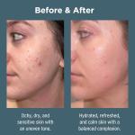 Hydrating Face Moisturiser for Sensitive Skin 75ml