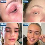 Natural Face & Eyelid Oil for Dry Skin Relief