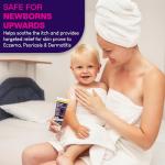Hope's Relief Natural Dry Skin Cream 3 Pack