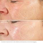 Retinol Night Cream with Hyaluronic Acid & Vitamin E