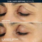 RoC Retinol Eye Cream for Wrinkles and Puffiness