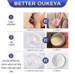 Urea Cream 42% with Salicylic Acid for Dry Skin