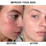 High Power Red Light Therapy Lamp for Skin