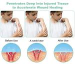 Portable Red Light Therapy Device for Pain Relief