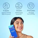 Differin Retinoid Acne Treatment Gel for Sensitive Skin