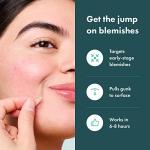 Hydrocolloid Pimple Patches for Face Blemishes