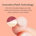Rael Invisible Acne Patches for Spot Treatment
