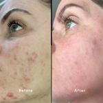 Elixir Face Oil Serum, Highly Effective Bioactive Natural & Organic Oils, Anti-aging, Reduces Fine Lines & Acne Scars, Handmade in UK 30ml