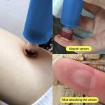 Emergency Snake and Bee Bite First Aid Kit