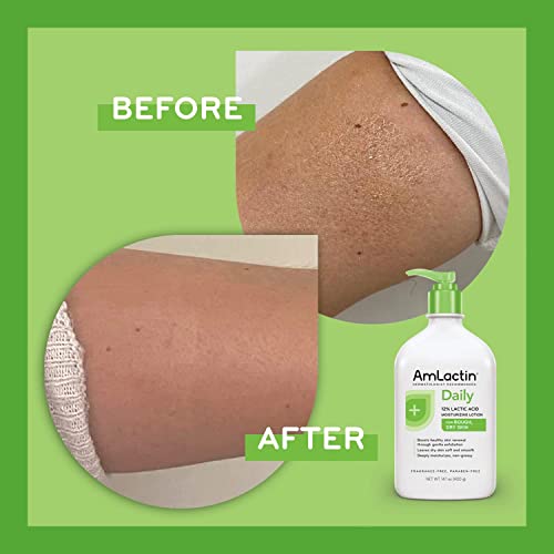 AmLactin Daily Moisturizing Lotion for Dry Skin – 14.1 oz Pump Bottle – 2-in-1 Exfoliator and Body Lotion with 12% Lactic Acid, Dermatologist-Recommended Moisturizer for Soft Smooth Skin