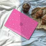 Hot Pink Hard Shell Case for MacBook Pro 13