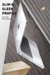 SUPCASE Clear Case for 14" MacBook Pro 2021-2025