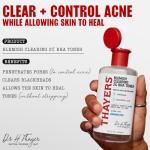 Thayers Acne Treatment Toner with Salicylic Acid