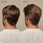 Tea Tree Scalp Care Conditioner for Thinning Hair