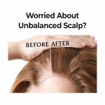 KUNDAL 10X Caffeine Hair Loss Serum Roll-On