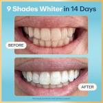 Lumineux Peroxide Free Teeth Whitening Strips