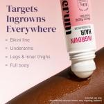 Razor Bump Stopper and Dark Spot Remover