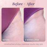 Razor Bump Stopper and Dark Spot Remover