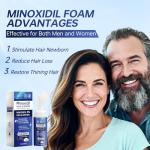 5% Minoxidil Foam for Hair and Beard Growth