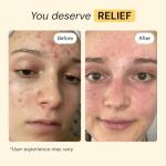 MyMagicHealer Thyme & Tea Tree Skin Care 1 oz