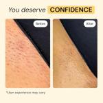 MyMagicHealer Thyme & Tea Tree Skin Care 1 oz