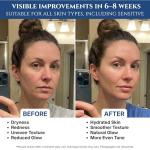 Copper Peptide Serum with EGF and Hyaluronic Acid