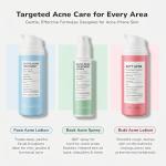 BellamiLuxx Acne Treatment Cream with Salicylic Acid