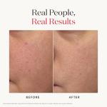 SK-II Facial Treatment Essence - Anti-Aging Skin Care