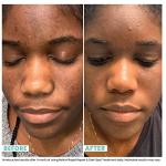 Urban Skin Rx® Retinol Dark Spot Repair Serum